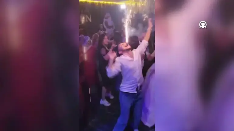 Düğünde yaktığı meşale ağzında patladı - 2