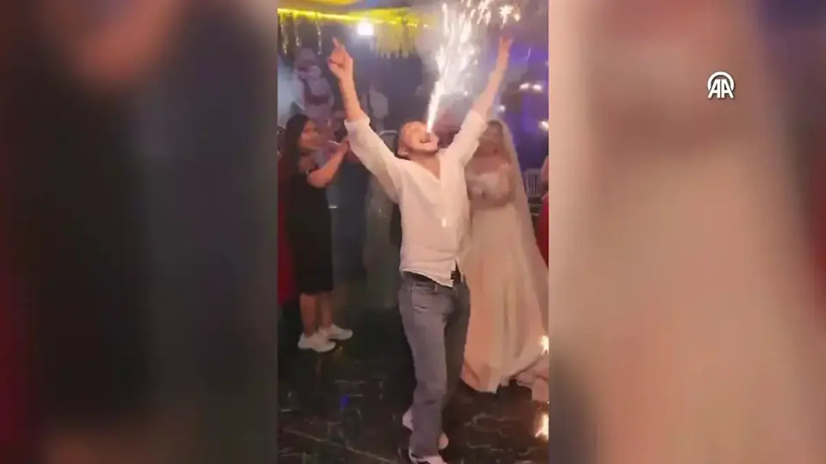 Düğünde yaktığı meşale ağzında patladı