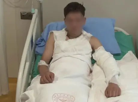 15 yaşındaki çocuğun merakı kabusu oldu! 'Çakmağı çaktı bomba gibi patladı'